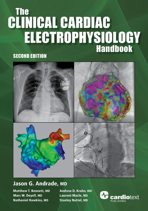 Clinical Cardiac Electrophysiology Handbook, Second Edition - Jason Andrade