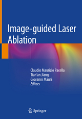 Image-guided Laser Ablation - 