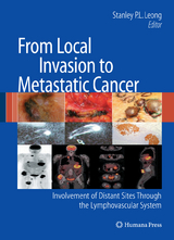 From Local Invasion to Metastatic Cancer - 