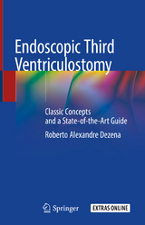 Endoscopic Third Ventriculostomy - Roberto Alexandre Dezena