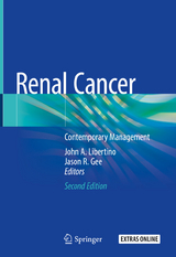 Renal Cancer - 