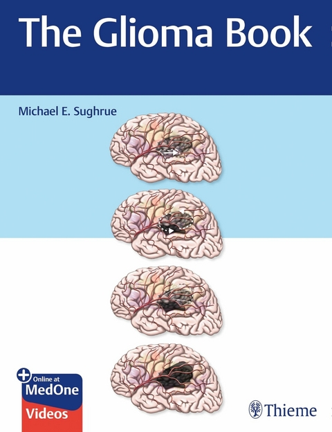 The Glioma Book -  Michael E. Sughrue