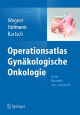 Operationsatlas Gynäkologische Onkologie - 