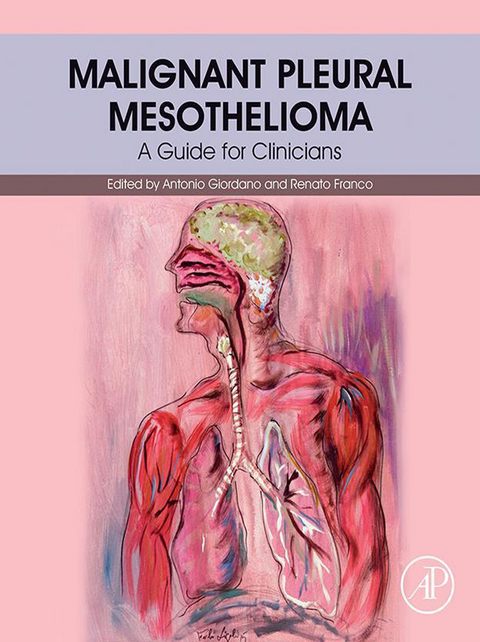 Malignant Pleural Mesothelioma - 