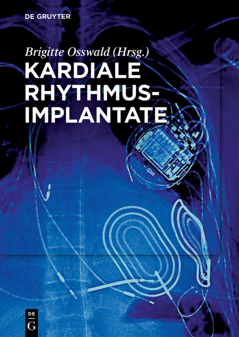 Kardiale Rhythmusimplantate - 