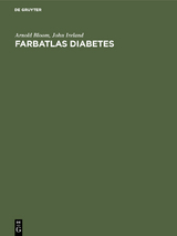 Farbatlas Diabetes - Arnold Bloom, John Ireland