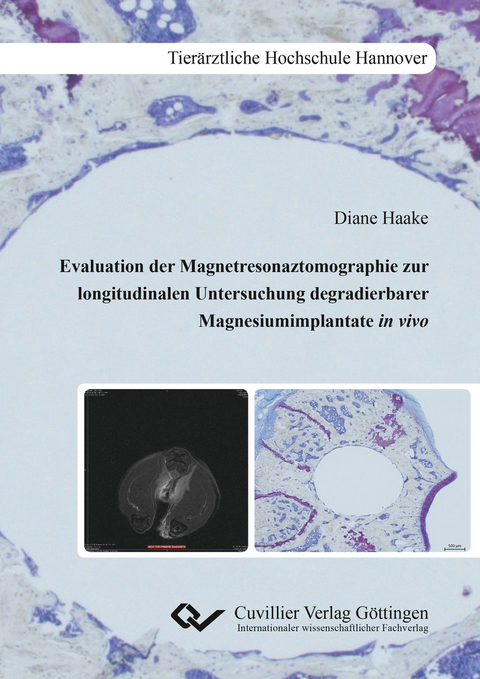 Evaluation der Magnetresonaztomographie zur longitudinalen Untersuchung degradierbarer Mag-nesiumimplantate in vivo -  Diane Haake