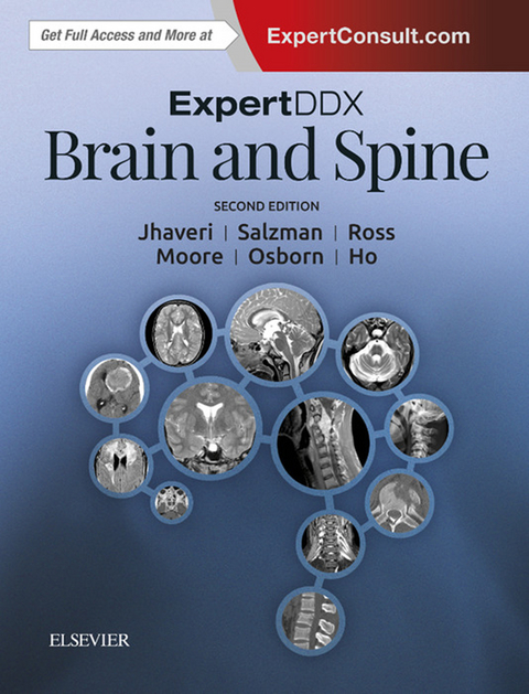 ExpertDDx: Brain and Spine E-Book -  Chang Yueh Ho,  Miral D. Jhaveri,  Anne G. Osborn,  Jeffrey S. Ross,  Karen L. Salzman