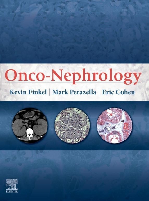 Onco-Nephrology E-Book -  Eric P Cohen,  Kevin W. Finkel,  Mark Anthony Perazella