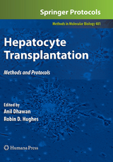 Hepatocyte Transplantation - 