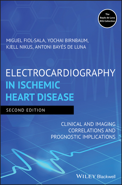 Electrocardiography in Ischemic Heart Disease - Miquel Fiol-Sala, Yochai Birnbaum, Kjell Nikus, Antoni Bayés de Luna