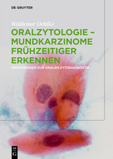 Oralzytologie - Mundkarzinome frühzeitiger erkennen - Waldemar Oehlke