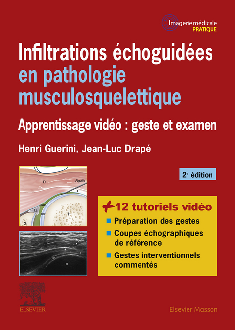 Infiltrations échoguidées en pathologie musculosquelettique -  Jean-Luc Drape,  Henri Guerini,  Paul Legmann