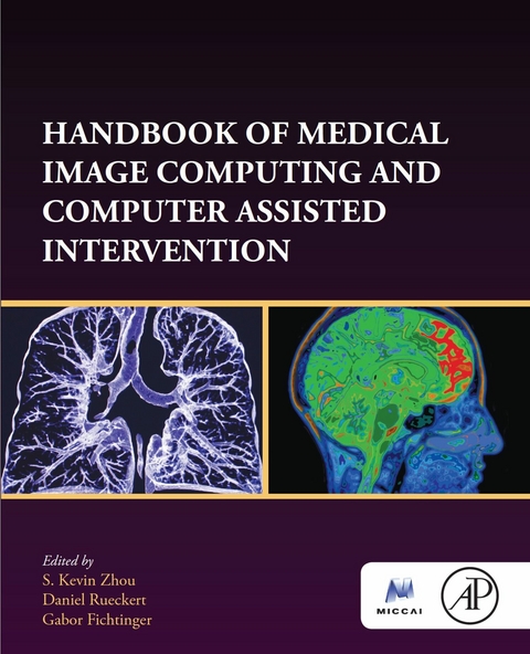 Handbook of Medical Image Computing and Computer Assisted Intervention - 