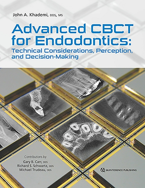 Advanced CBCT for Endodontics - John A Khademi, Gary B. Carr, Richard S. Schwartz, Michael Trudeau