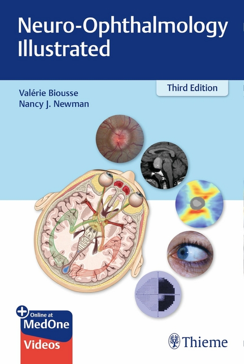 Neuro-Ophthalmology Illustrated -  Valerie Biousse,  Nancy Newman