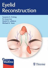 Eyelid Reconstruction -  Suzanne K. Freitag,  Nahyoung Grace Lee,  Daniel R. Lefebvre,  Michael K. Yoon