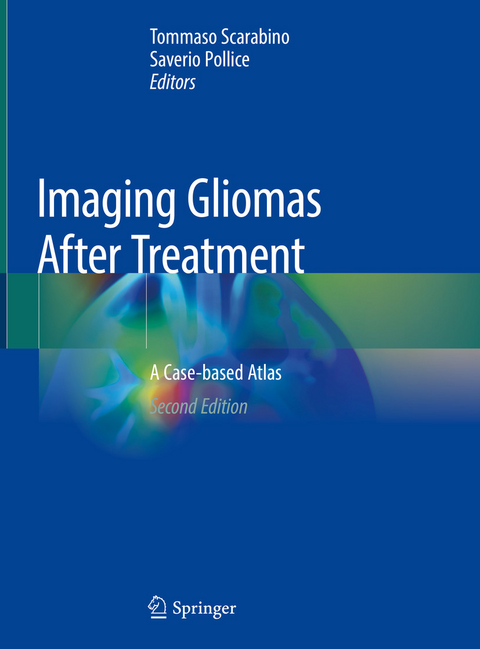 Imaging Gliomas After Treatment - 