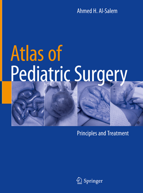 Atlas of Pediatric Surgery - Ahmed H. Al-Salem