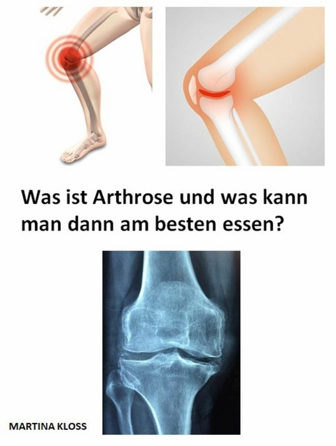 Was ist Arthrose und was kann man dann am besten essen? - Martina Kloss