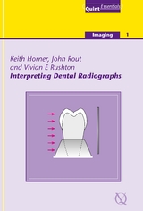 Interpreting Dental Radiographs - Keith Horner, John Rout, Vivian E. Rushton