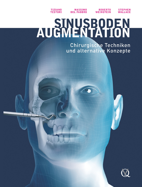 Sinusbodenaugmentation - Tiziano Testori, Massimo del Fabbro, Roberto Weinstein, Stephan Wallace