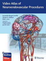 Video Atlas of Neuroendovascular Procedures -  Leonardo Rangel-Castilla,  Adnan H. Siddiqui,  Elad I. Levy,  Giuseppe Lanzino,  Jason Davies,  L. Nelson