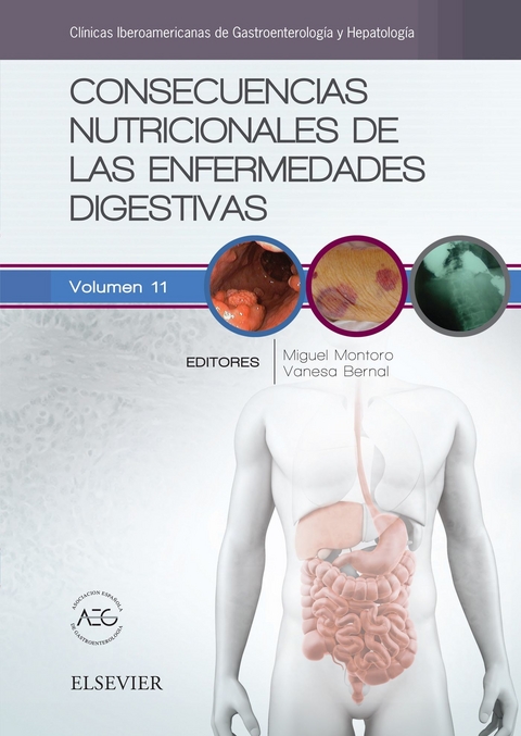 Consecuencias nutricionales de las enfermedades digestivas - 