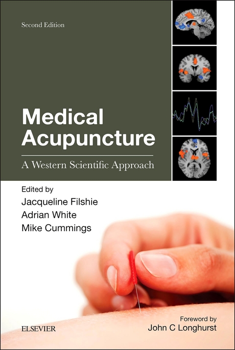 Medical Acupuncture E-Book - 