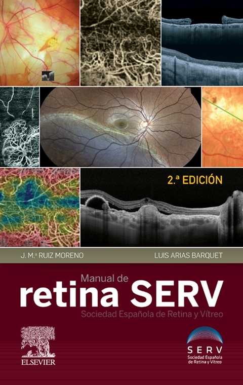 Manual de retina SERV - 