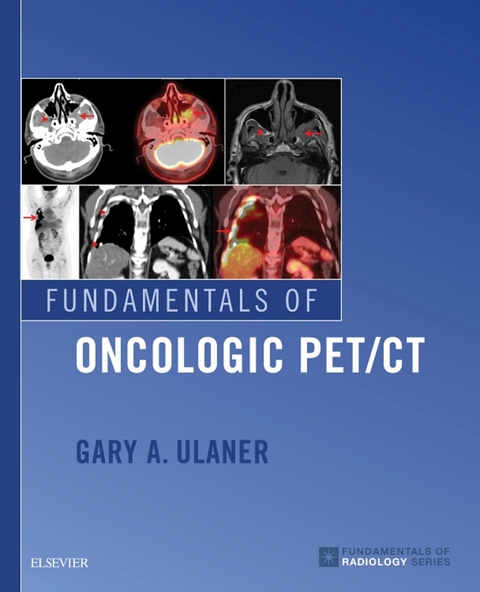 Fundamentals of Oncologic PET/CT E-Book -  Gary A. Ulaner