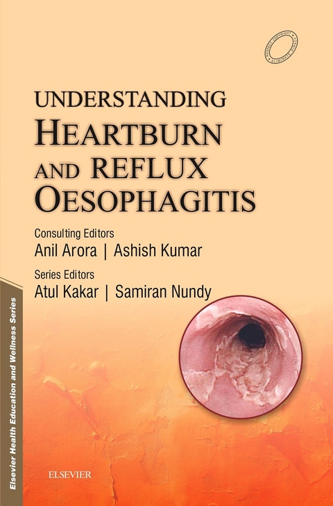 Understanding Heartburn and Reflux Oesophagitis - e-Book -  Samiran Nundy