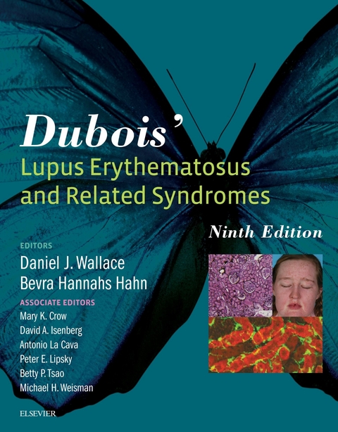 Dubois' Lupus Erythematosus and Related Syndromes - E-Book -  Bevra Hahn,  Daniel J. Wallace