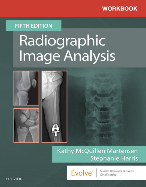 Workbook for Radiographic Image Analysis E-Book -  Kathy McQuillen Martensen