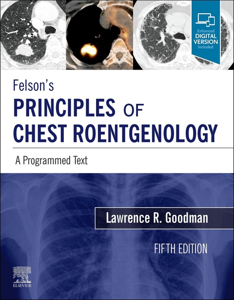 Felson's Principles of Chest Roentgenology E-Book -  Lawrence R. Goodman