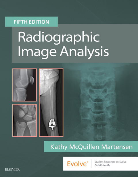 Radiographic Image Analysis E-Book -  Kathy McQuillen Martensen