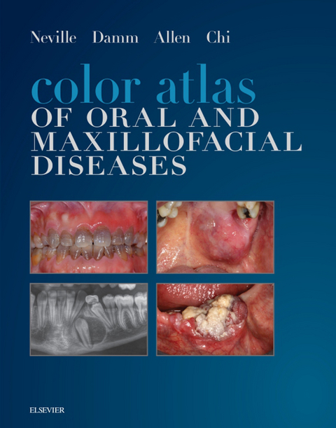 Color Atlas of Oral and Maxillofacial Diseases - E-Book -  Carl M. Allen,  Angela C. Chi,  Douglas D. Damm,  Brad W. Neville