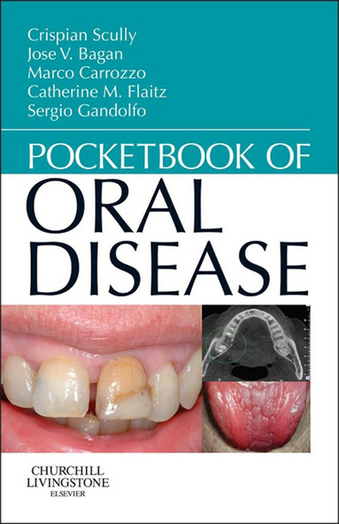 Pocketbook of Oral Disease - E-Book -  Marco Carrozzo,  Catherine M Flaitz,  Sergio Gandolfo,  Crispian Scully,  Jose Vicente Bagan Sebastian