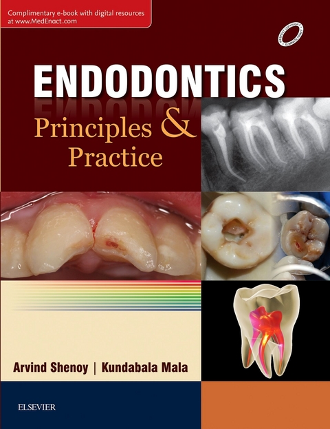 Endodontics: Principles and Practice E-book -  KUNDABALA MALA,  Arvind Shenoy