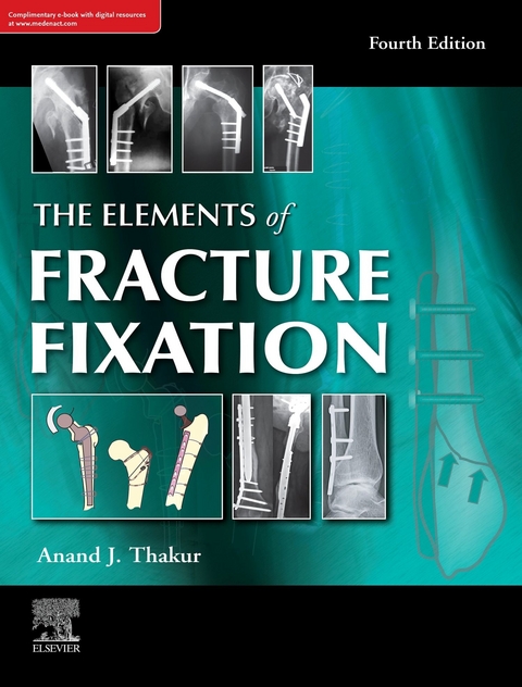 elements of fracture fixation, 4e -  Anand J. Thakur