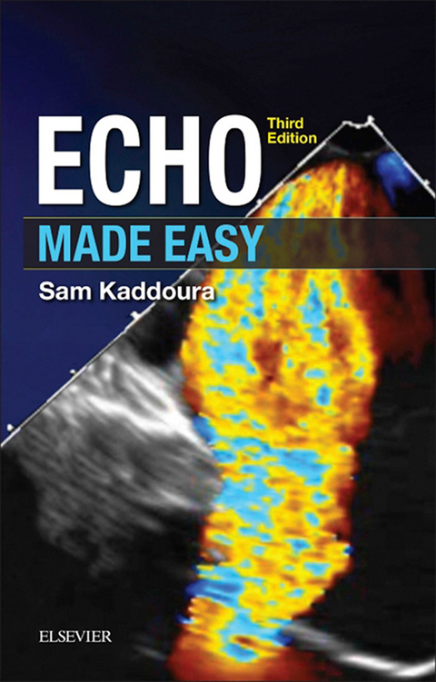 Echo Made Easy E-Book -  Sam Kaddoura