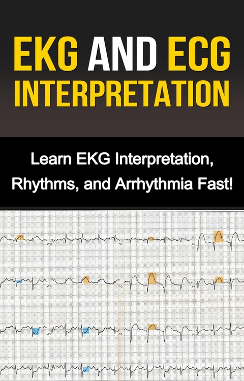 EKG and ECG Interpretation - Alyssa Stone