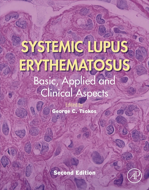 Systemic Lupus Erythematosus - 