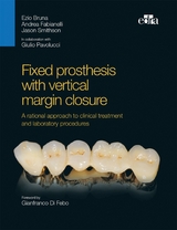 Fixed prosthesis with vertical margin closure - Ezio Bruna, Andrea Fabianelli, Jason Smithson