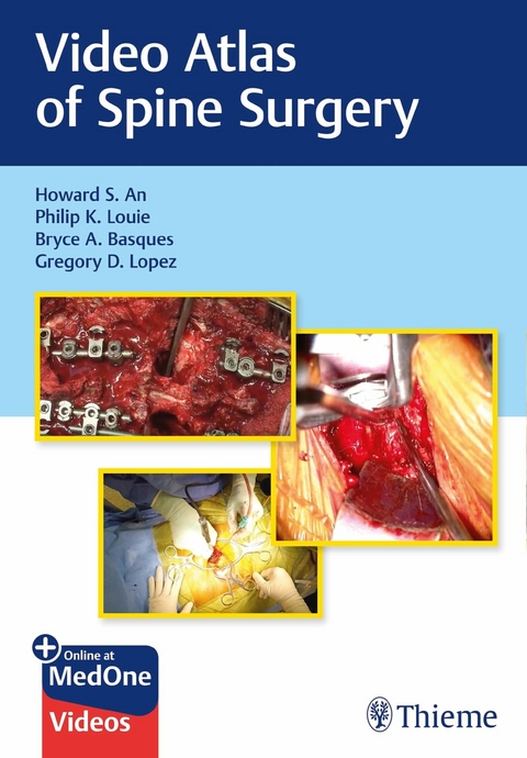 Video Atlas of Spine Surgery -  Howard S. An,  Philip K. Louie,  Bryce Basques,  Gregory Lopez