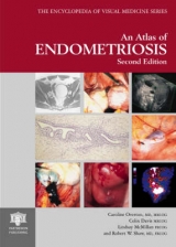 Atlas of Endometriosis - 