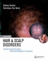 Hair and Scalp Disorders - Dawber, Rodney P. R.; Van Neste, Dominique