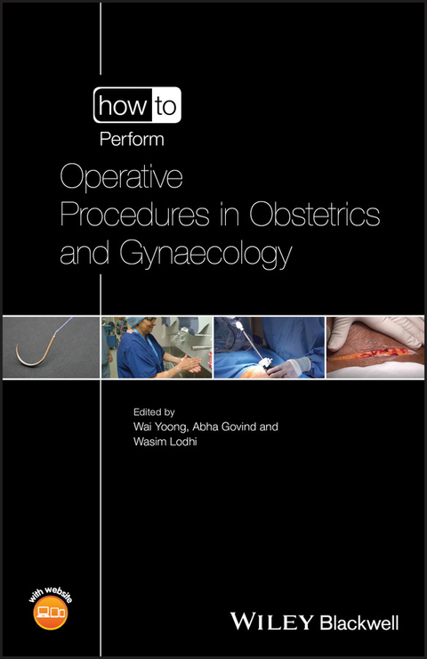 How to Perform Operative Procedures in Obstetrics and Gynaecology - 