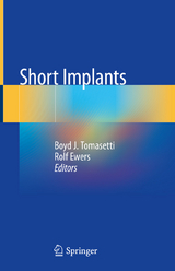 Short Implants - 