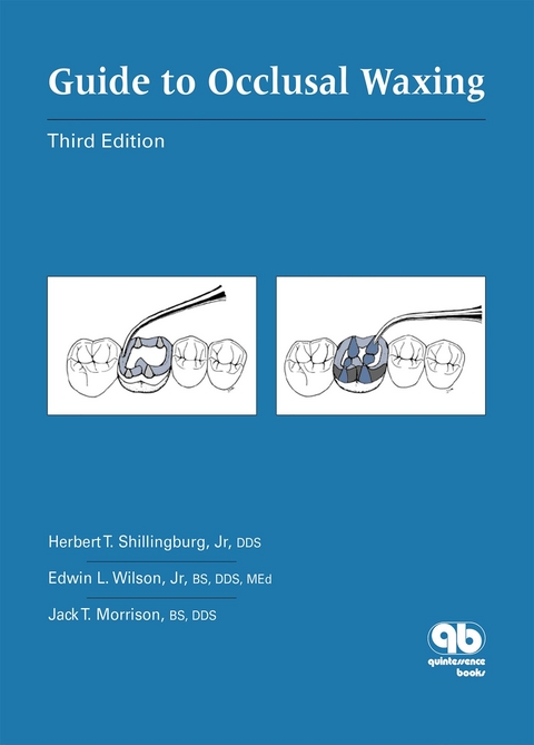 Guide to Occlusal Waxing - Herbert T. Shillingburg Jr, Edwin L. Wilson Jr, Jack T. Morrison